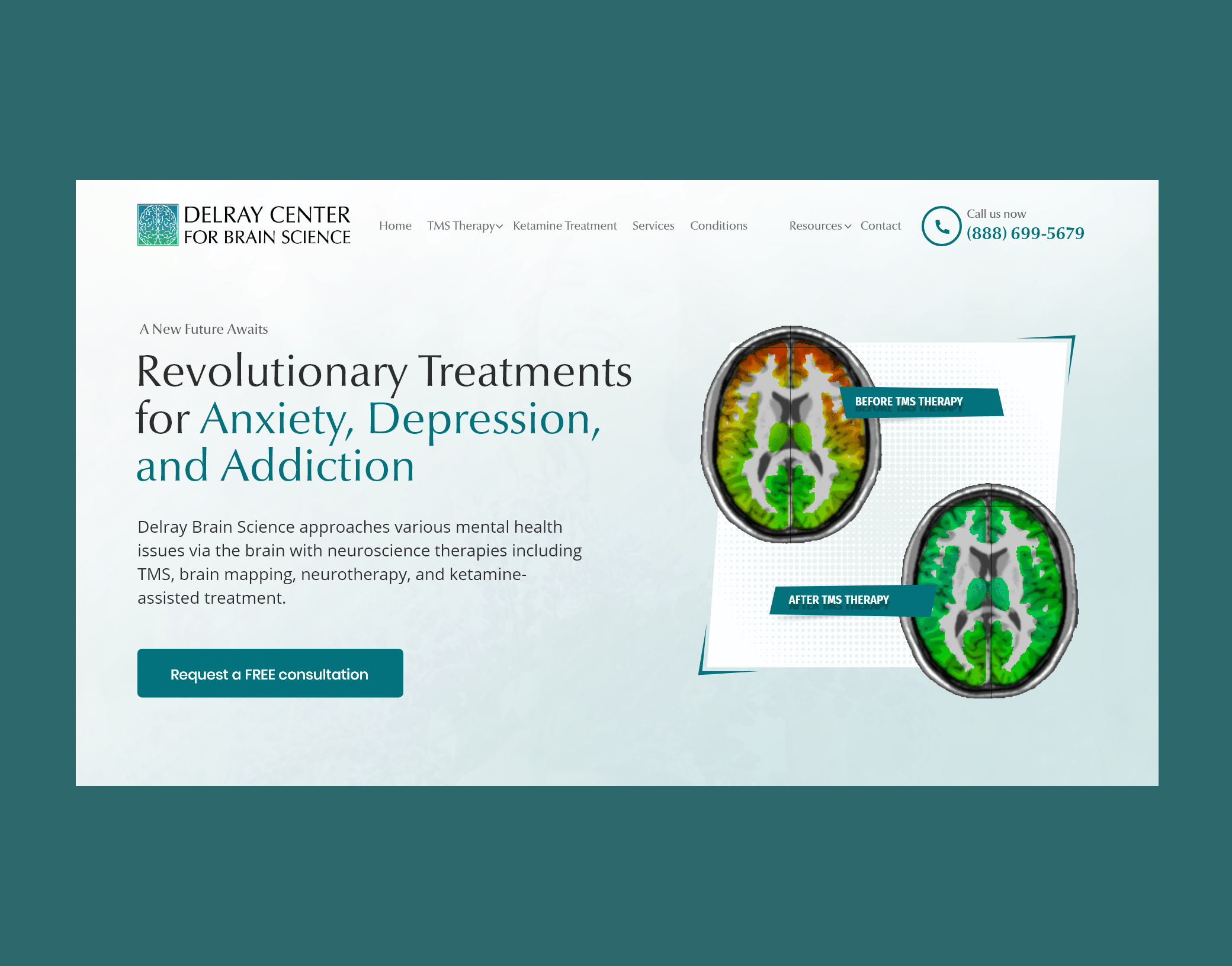 Delray Brain Science